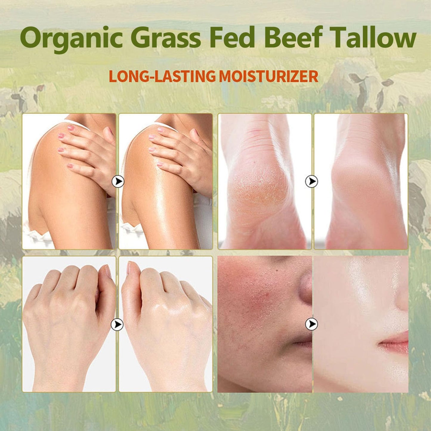 Vbolre Grass Fed Beef Tallow with Frankincense Oil and Castor Oil, Organic Grass Fed Beef Tallow for Skin, Whipped Beef Tallow Frankincense Oil Castor Oil for Skin Face Body Moisturizer (1)