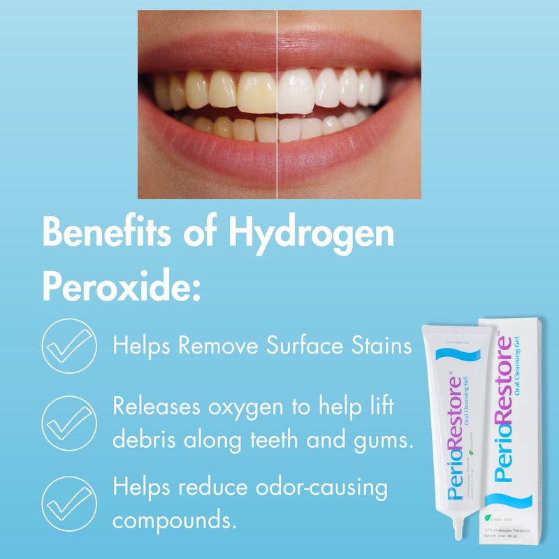 Perio Restore® Gel 3oz – 1.7% Hydrogen Peroxide Teeth Whitening & Oral Care Gel, Mint Flavor, Includes 2 Trays for Easy At-Home Application