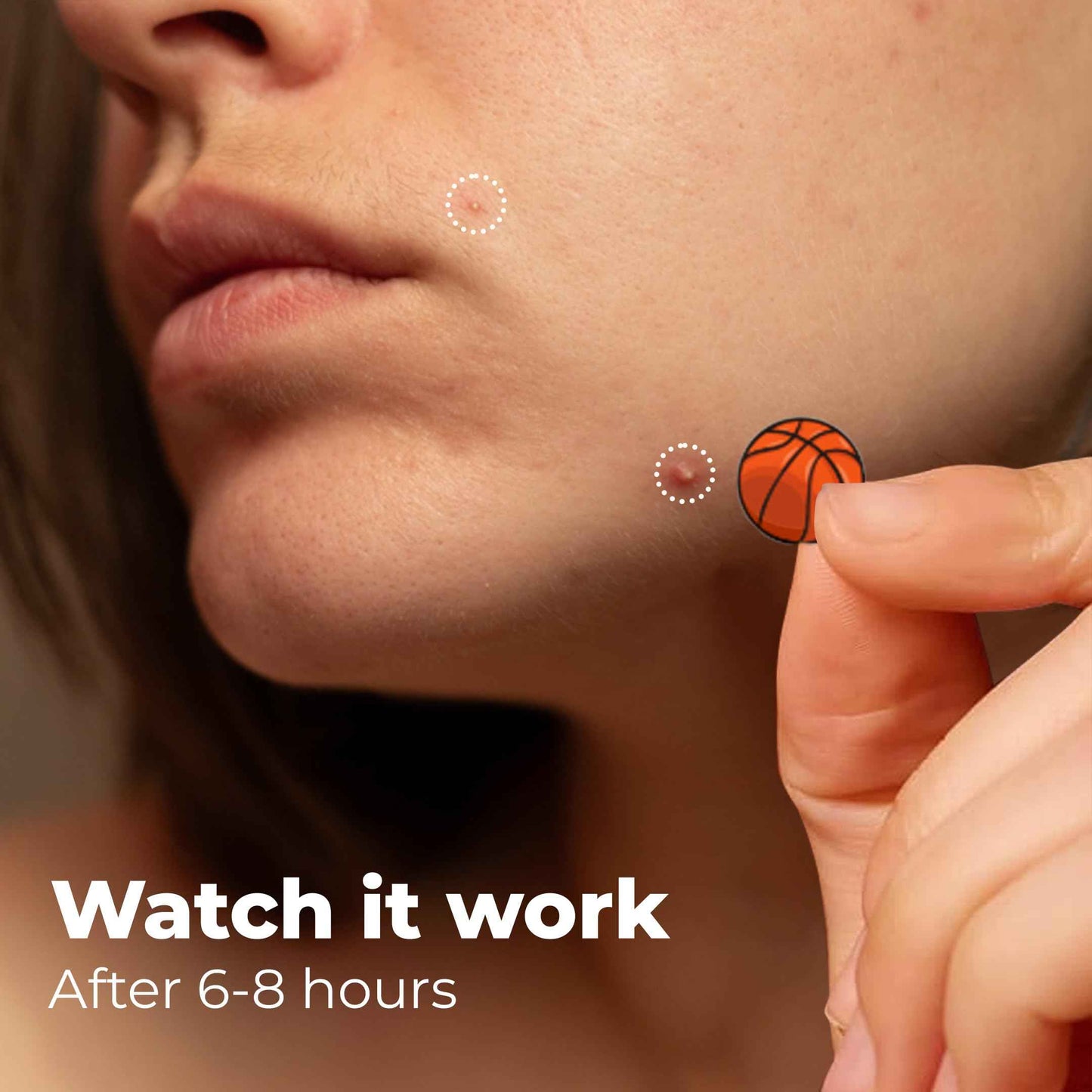 Sporty Acne Patches – Hydrocolloid Spot Cover for Zits, Pimples & Blemishes, Fast-Acting Formula, Long-Lasting & Gentle on Skin. (36 Count)