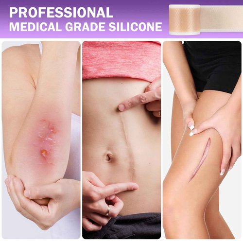 Silicone Scar Sheets, Hyaluronic Acid Nano Repair Tape, 2 Roll Silicone Scar Tape 1.6”x 60” Roll/1.5m, Silicone Scar Sheets for Surgical Scars,Scar Away Silicone Scar Sheets