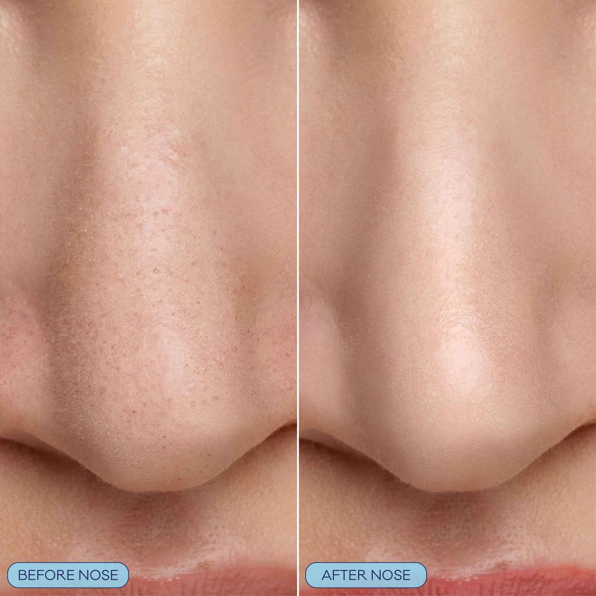 Bioré Pore Refining Bubbling Nose Mask, Glycolic Acid and Hyaluronic Acid Exfoliant for Face, Pore Cleansing Mask, 8 Ct