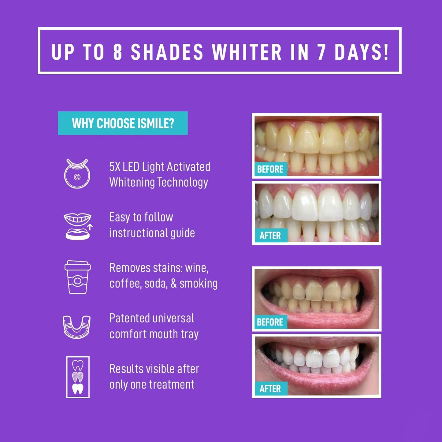 iSmile Teeth Whitening Kit - LED Light & 35% Carbamide Peroxide Gel | 3 Syringes & Remineralization Tray