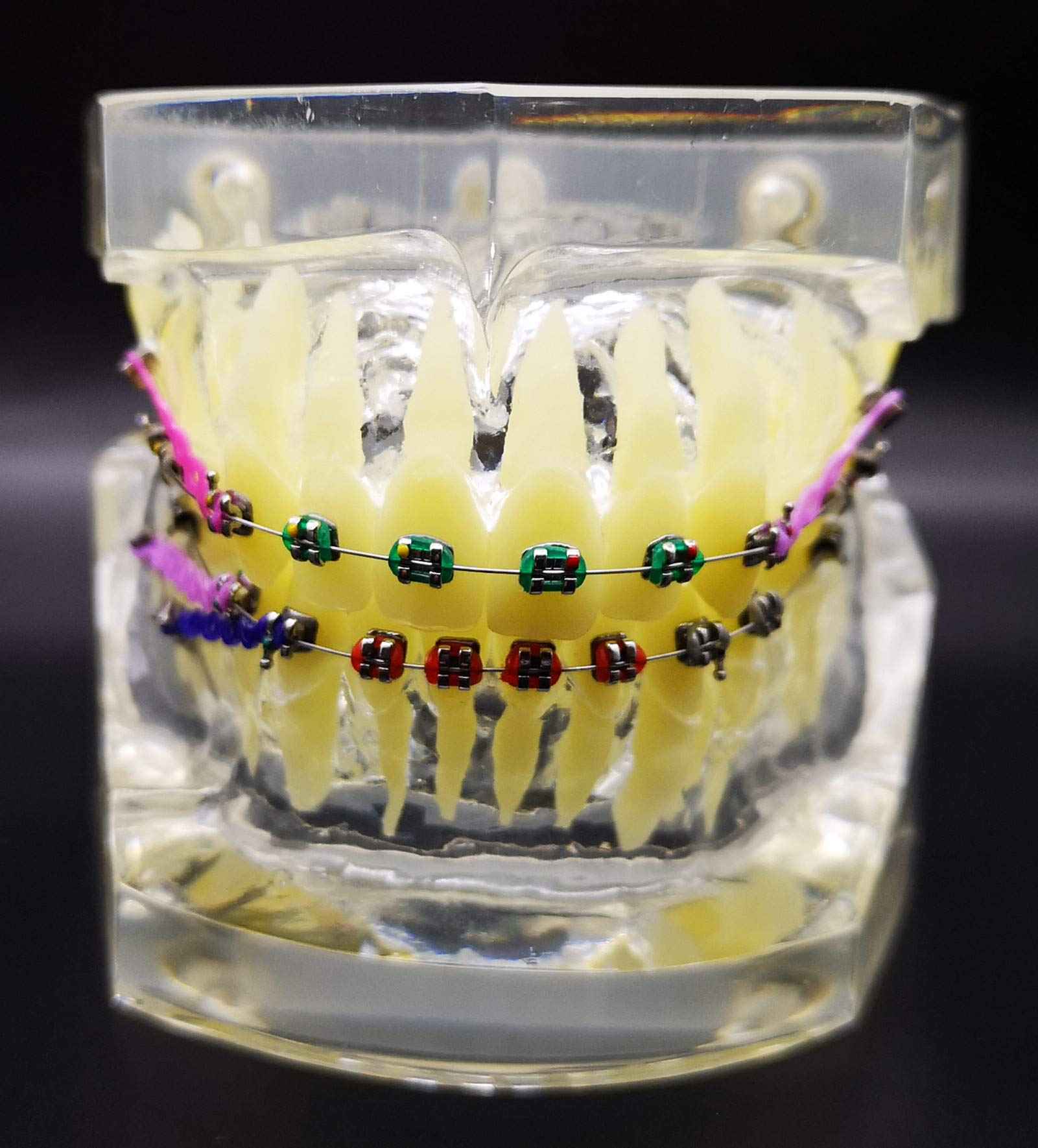 Dental Typodont with Metal Brackets Orthodontic Teeth Model with Ligature Tie