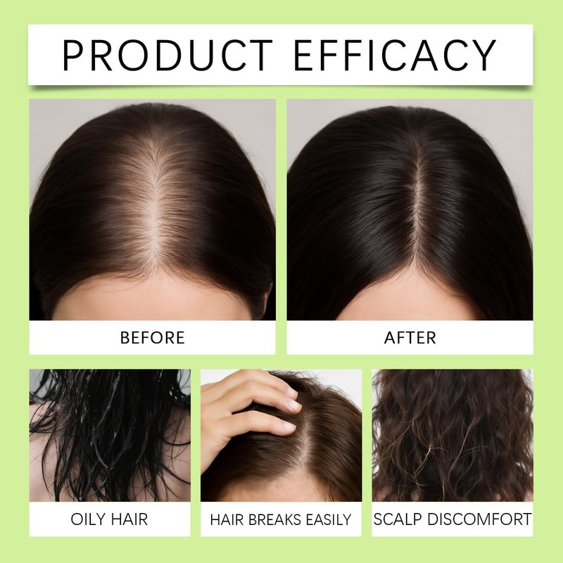 Hair Regrowth System, Advanced Hair Care with Ginseng, Eclipta Prostrata, Peppermint Oil and Ginger Root, Supports Fuller and Thicker Hair, Strengthens Roots for Men and Women