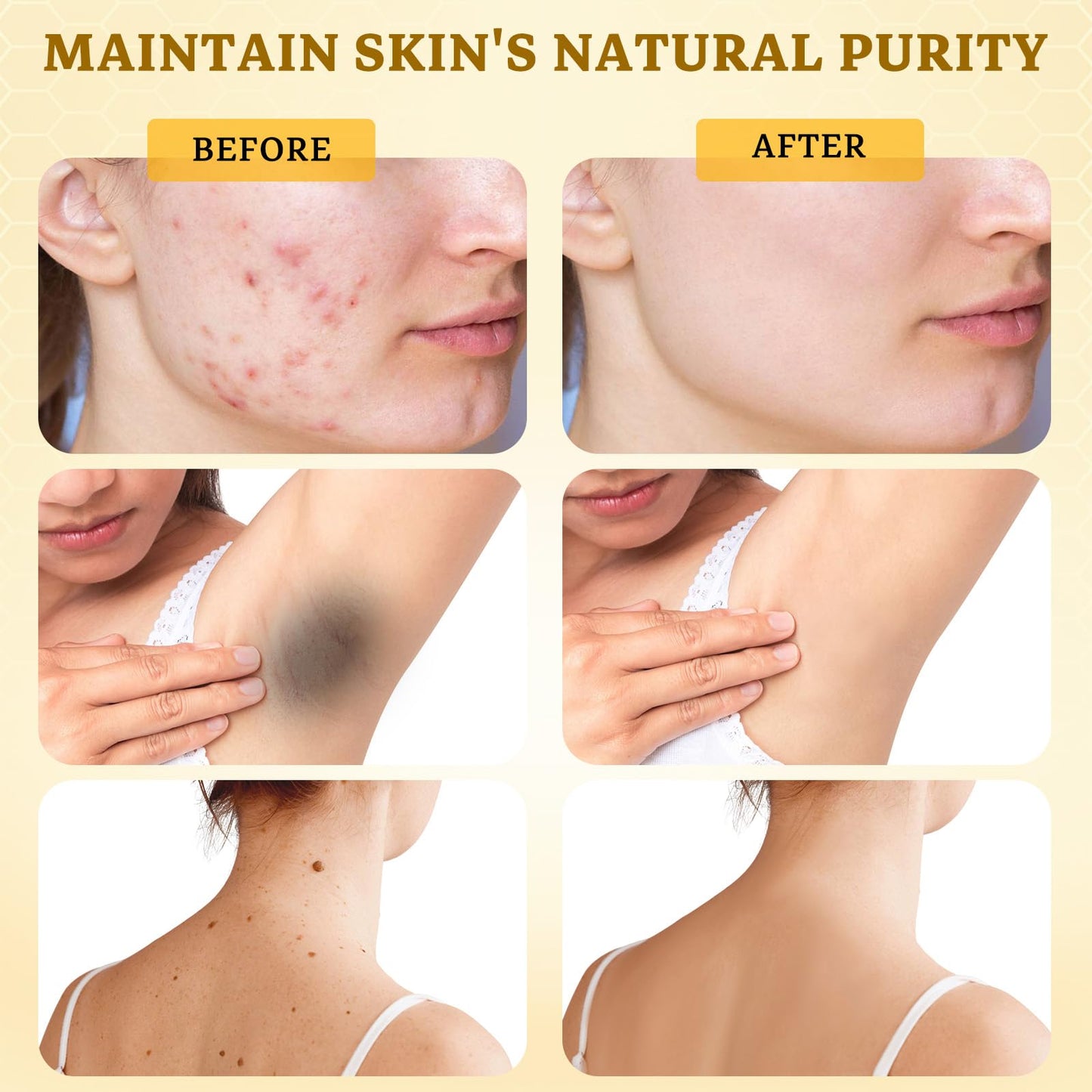 2PCS Bee Venom Comprehensive Cream: Wrinkle Care Face Lift & Firming, Effective In Reducing Skin Blemishes, Natural Care and Non-Irritating, Bee Venom Joint Cream for All Body Parts