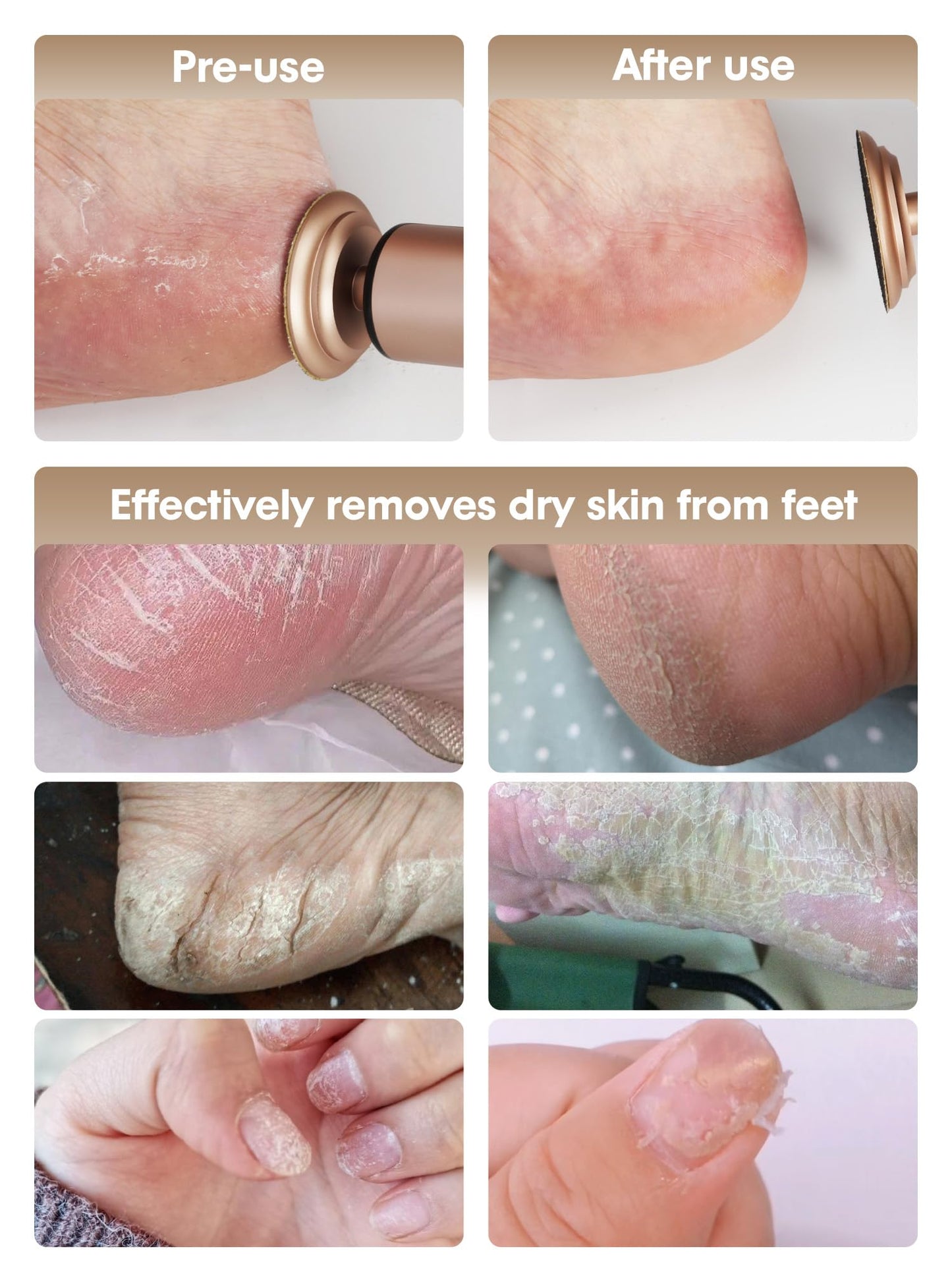 KIUCID Electric Foot Callus Remover - 2 in 1 Cordless Electric Foot File Nail Grinder,Electric Callus Remover for Feet with 3 Modes,Dry Skin Remover for Feet (Rose Gold)