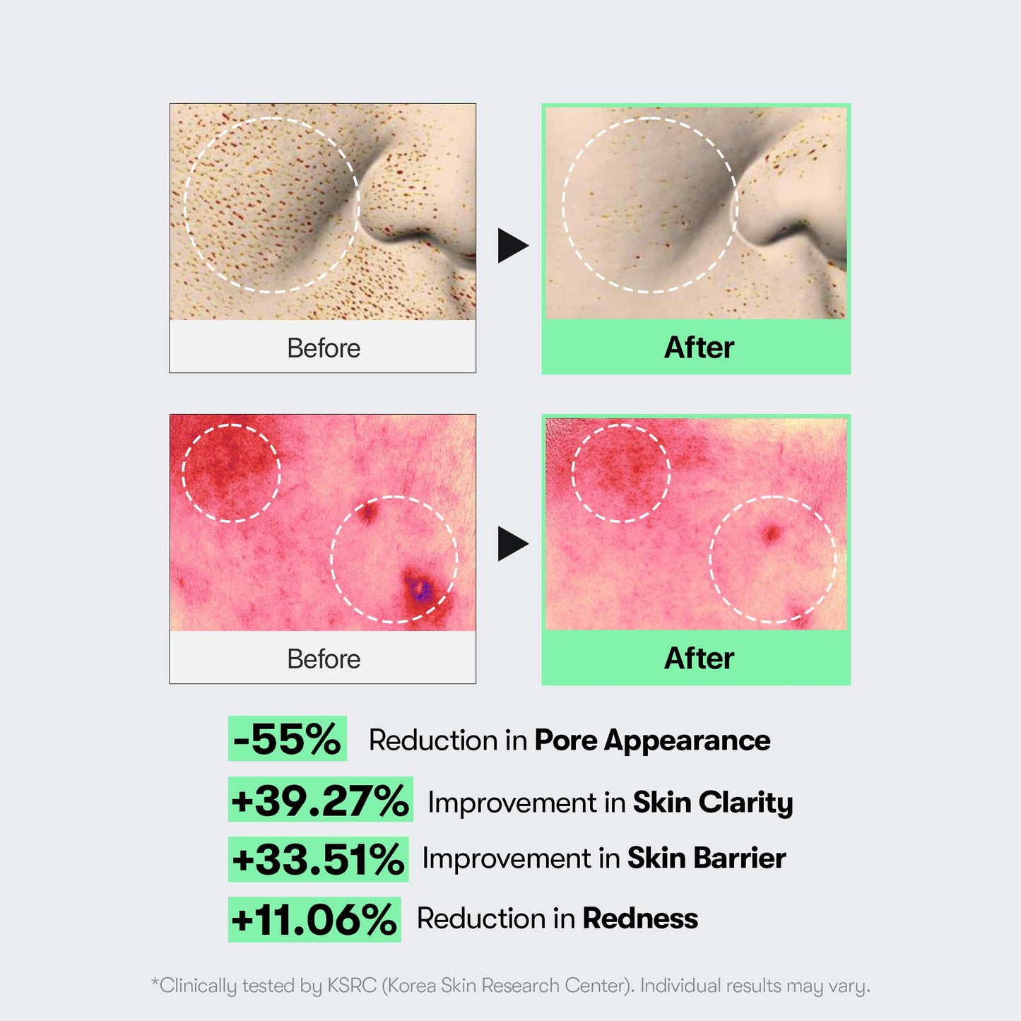 VT COSMETICS CICA Reedle Shot 100, Spicule Microneedling Serum for Pore Care & Exfoliation, Exosome, Centella Asiatica for Glass Skin, Skin Texture, Korean Liquid Skin Booster (1.69 Fl Oz / 50ml)