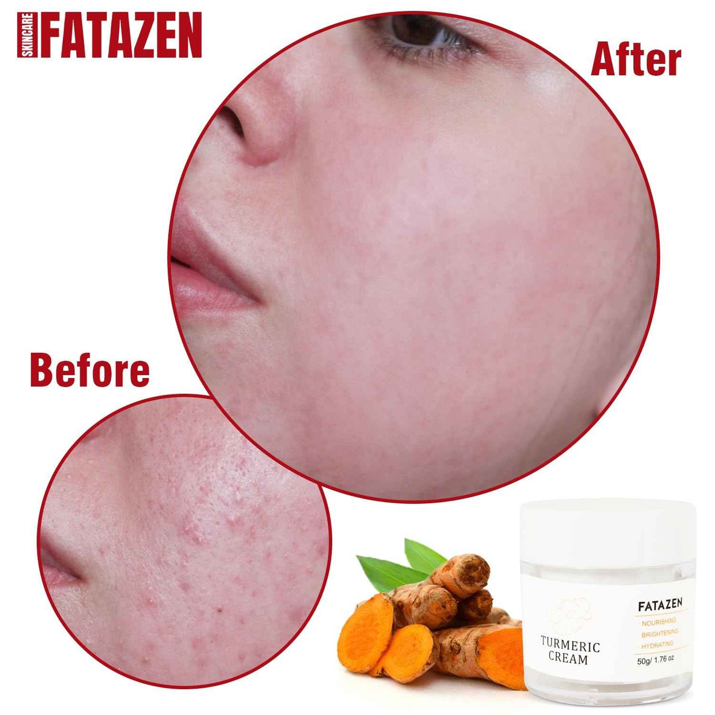 FATAZEN Turmeric Face Cream with Hyaluronic Acid & Aloe Vera for Acne-Prone Skin, Non-Comedogenic Daily Brightening Turmeric Moisturizer, Tea Tree Cream Calming Redness & Balancing Oily Sensitive Skin