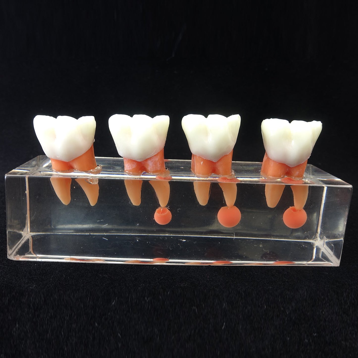 Dental Teeth Model 4-Stage Endodontic Treatment Model for Studying and Teaching …