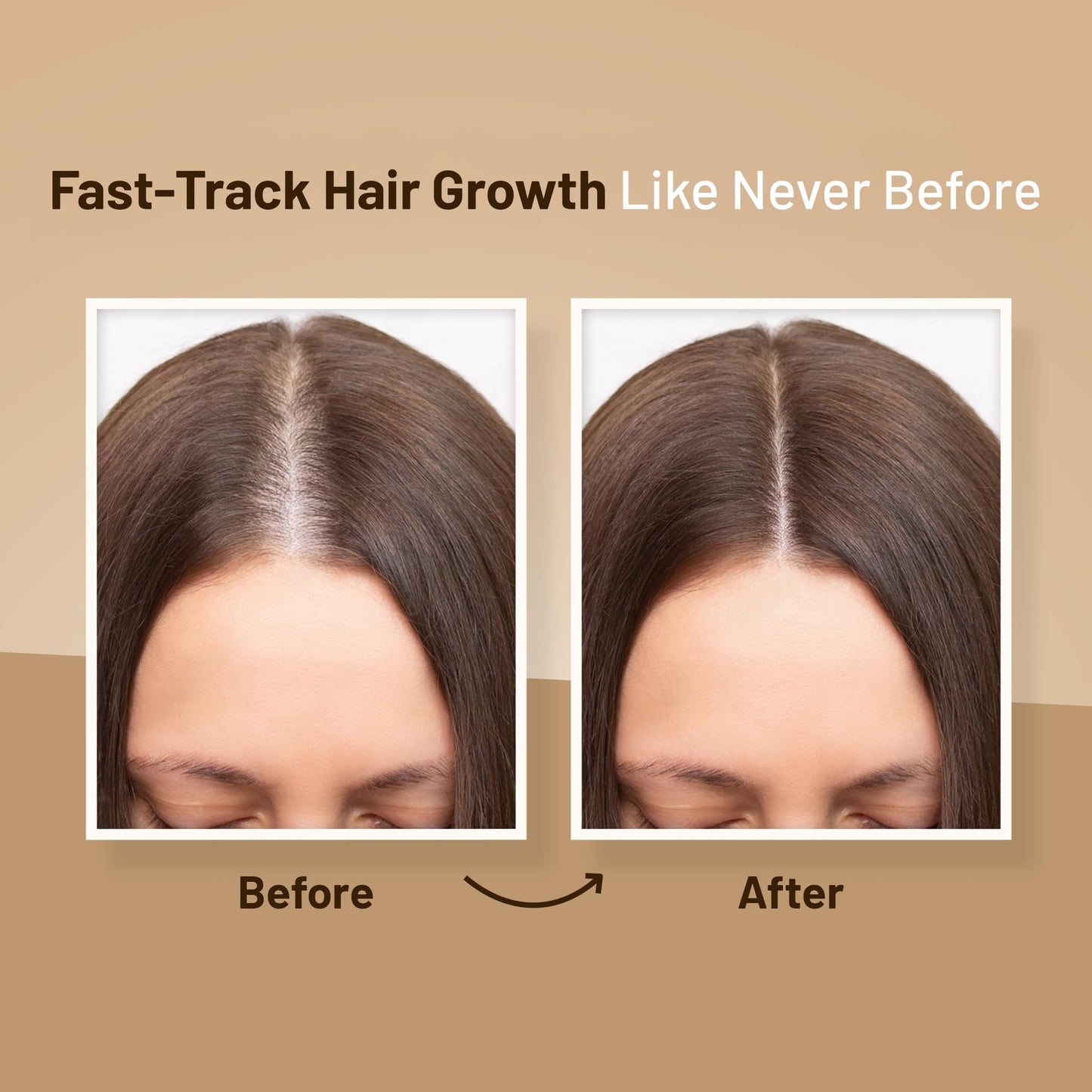Herbishh Thickening Shampoo and Conditioner | Hair Vitalizer | Hair Growth Essence Oil | Prevents Hair Loss - Supports Healthy Growth (4in1)