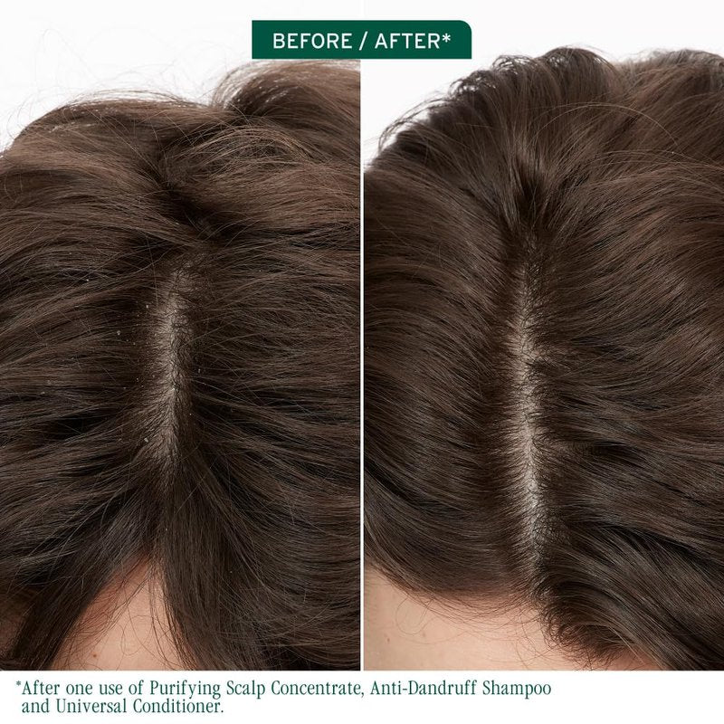 Biolage Scalp Sync Purifying Concentrate - For All Scalp Types, Exfoliating & Clarifying Treatment, Removes Buildup, Refreshing & Reinvigorating, Fermented Tea Blend & Glycolic Acid