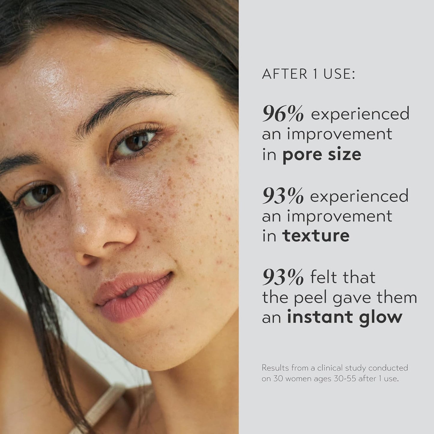 SHANI DARDEN SKIN CARE Triple Acid Peel - 2-Step Exfoliating Face Treatment with Mandelic & Glycolic Acids | 8 Peels + Mask & Brush