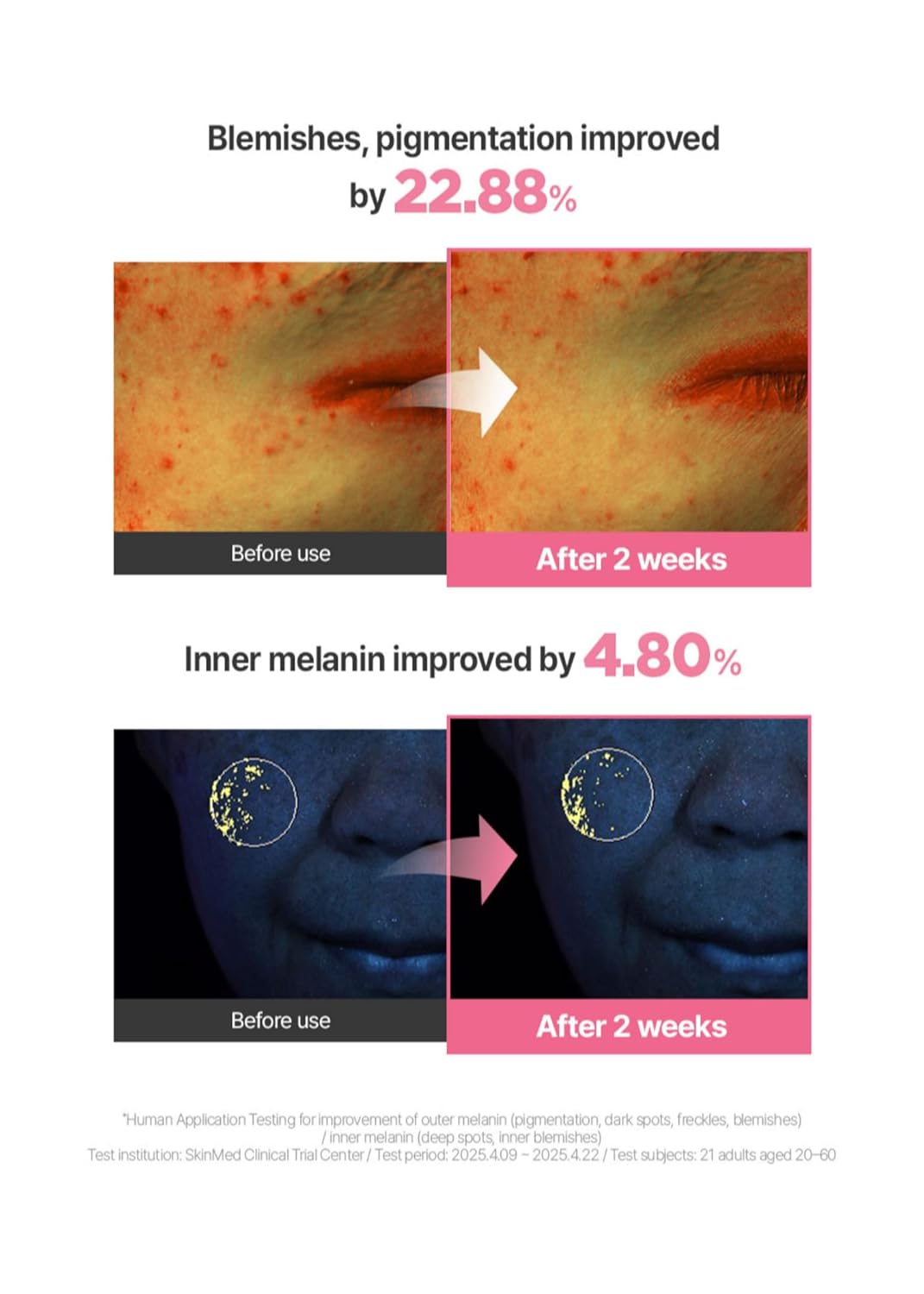 Glutathione Blemish Cream - Pink Guava Facial Moisturizer with 99% Pure Glutathione, Niacinamide & Vitamin C | 1.7 Fl Oz