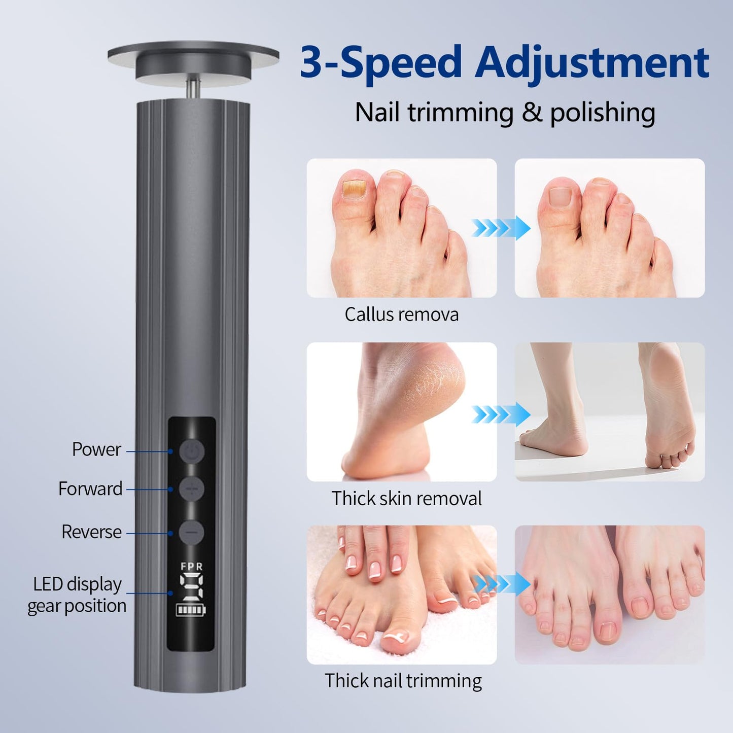 Tpyag Electric Feet Callus Remover, Foot Callus Remover, 9-Speed Adjustable Foot Grinding Tool, 2600mAh Battery, Includes 100 Sandpaper Sheets and Grinding Heads,Pedicure Tools for Dead Skin