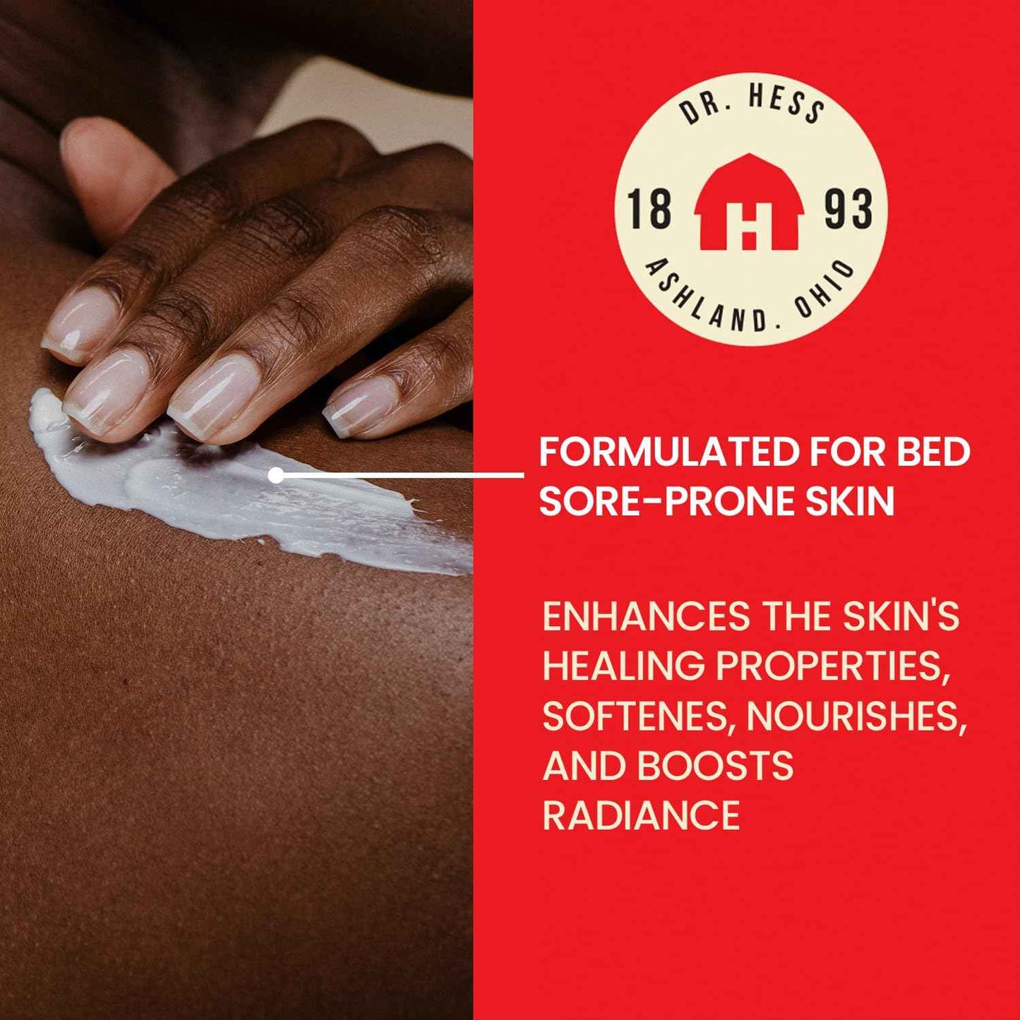 Dr. Hess Skin Moisturizer for Bed Sore Prone & Dry Skin, All Natural with Lanolin, Olive Oil, Jojoba Oil & Beeswax, Paraben & Sulfate Free, Hydrating Body & Face Cream, 4 oz, 2 Pack