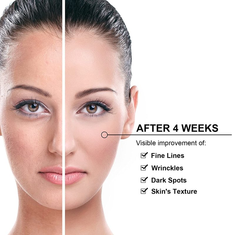 Elitzia Carbon Gel Peel Skin Care Rejuvenation Black Doll Facial Skin Deep Cleaning with Nano Activated Carbon for Laser Carbon Cream ETBDF80 80ml Pack of 2