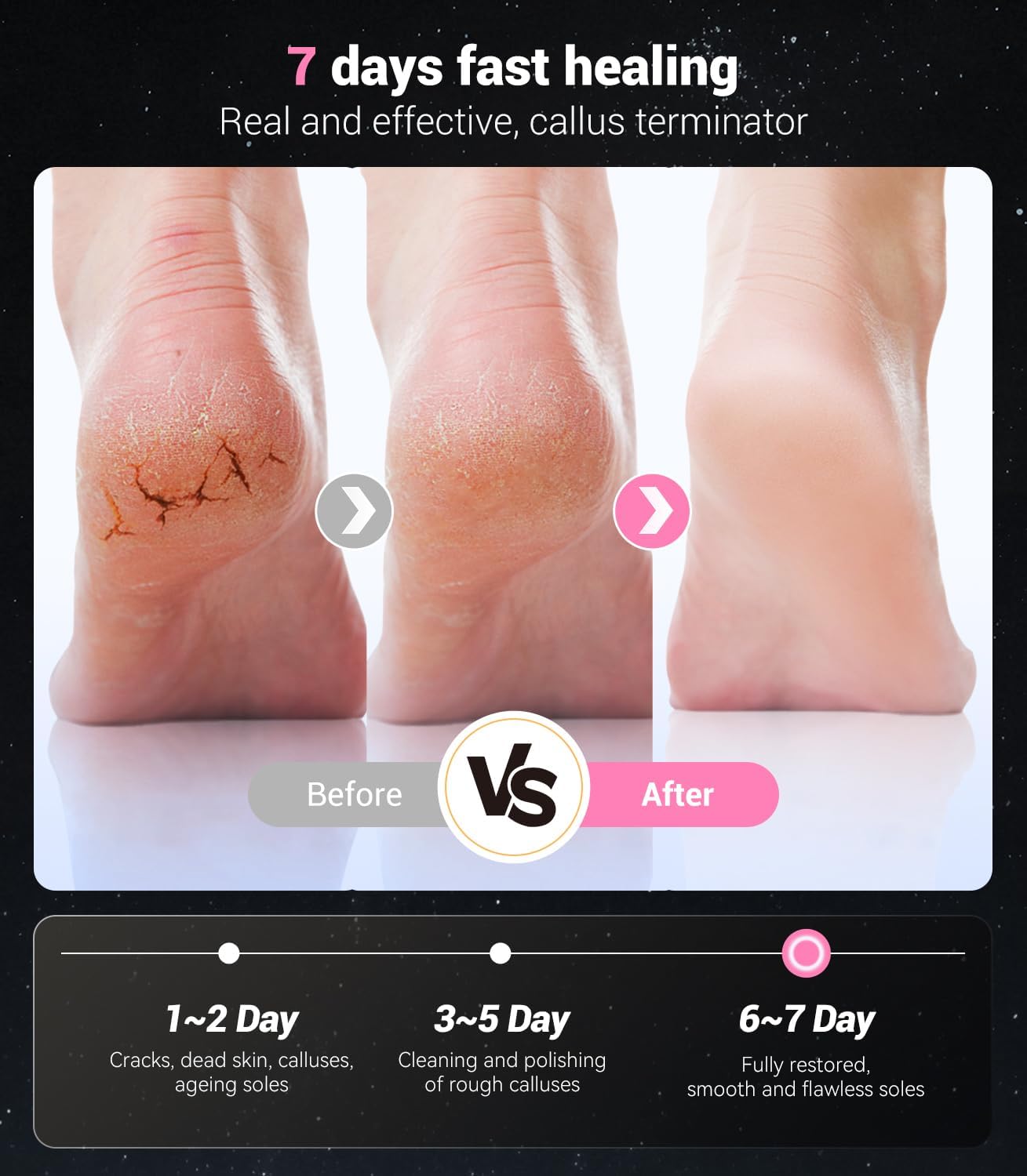 Electric Callus Remover - 5-in-1 Portable Foot Care Device | Removes 99.92% Calluses in 3 Mins, Pink