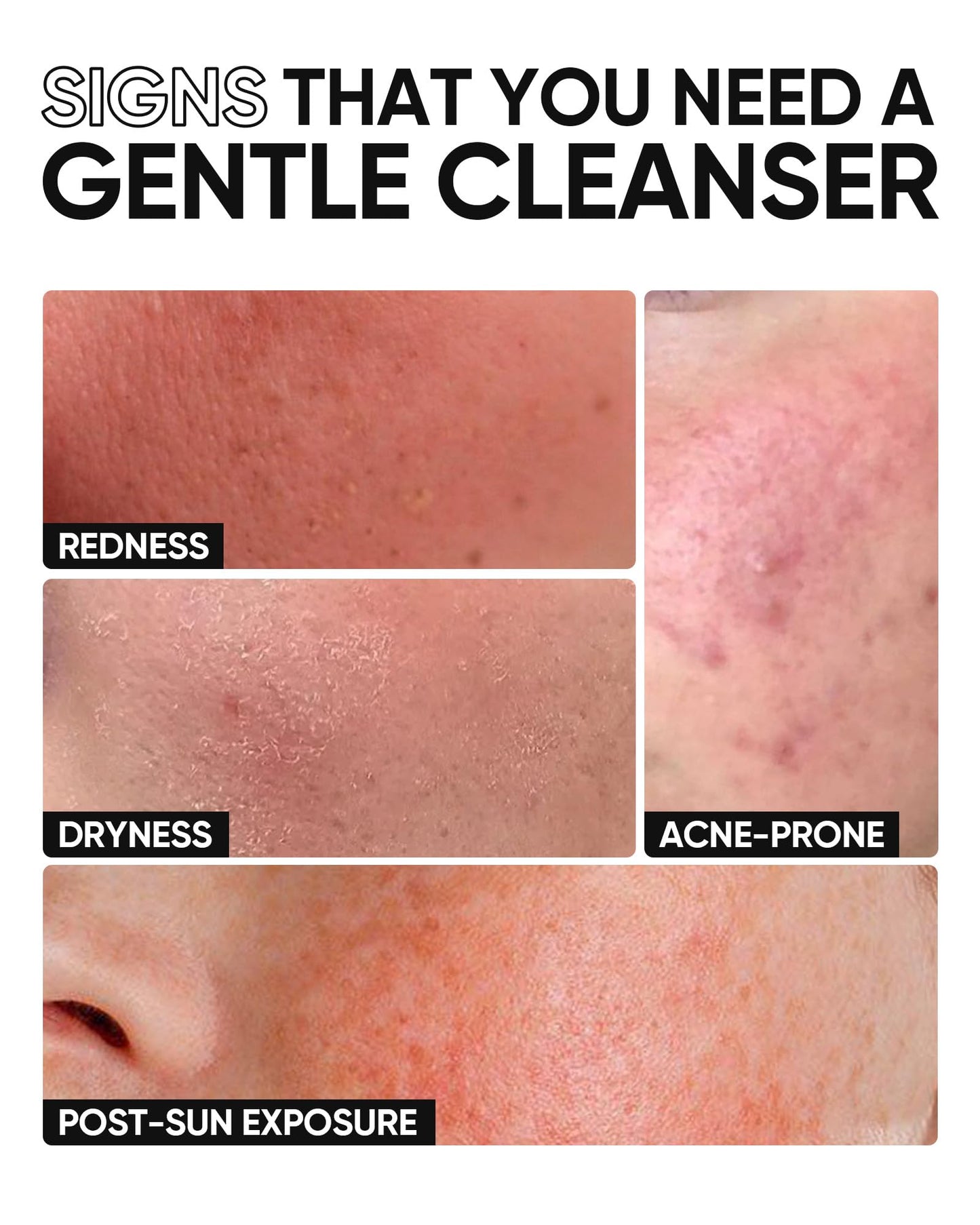 SKINTIFIC 5X Ceramide Low pH Facial Cleanser, Gentle Hydrating Face Wash with Hyaluronic Acid, Daily Face Wash for Dry to Normal Skin, Sensitive Skin Tested, Not Tight, Fragrance Free
