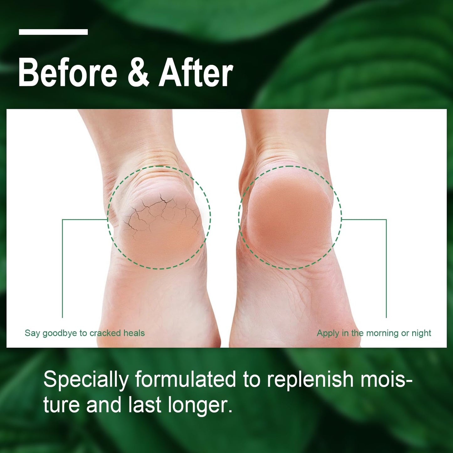 LEBARED Urea Cream 40 Percent For Feet Maximum Strength, Plus 2% Salicylic Acid with Hyaluronic Acid, Urea Foot & Hand Cream for Dry Cracked, 4.6 oz