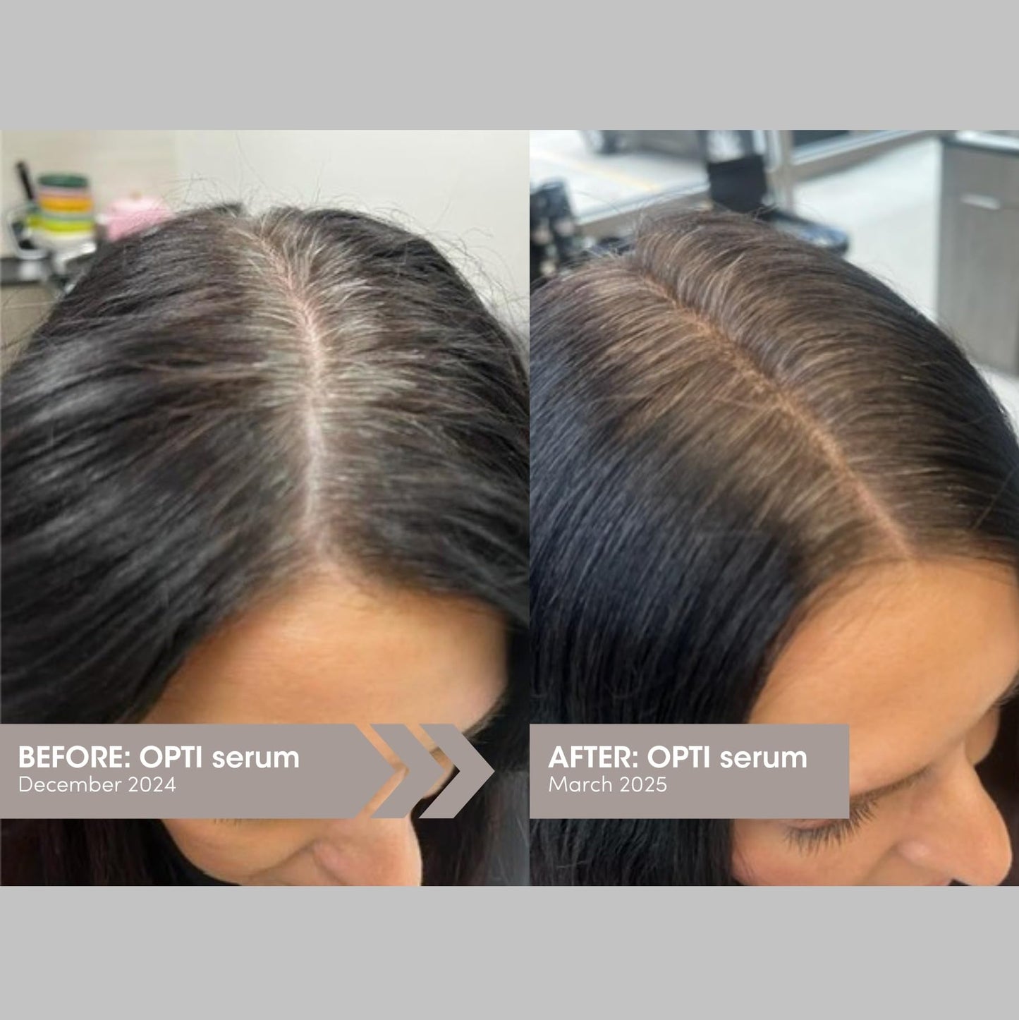 SEVEN Satara Opti Anti Grey Hair Serum, Triple-Action Oil Serum for Anti-Frizz & Damaged Hair Growth, Shine Enhancing, Frizzy Control, Color Reversal, Thinning Reduction, 1.4 fl oz, 42 ml
