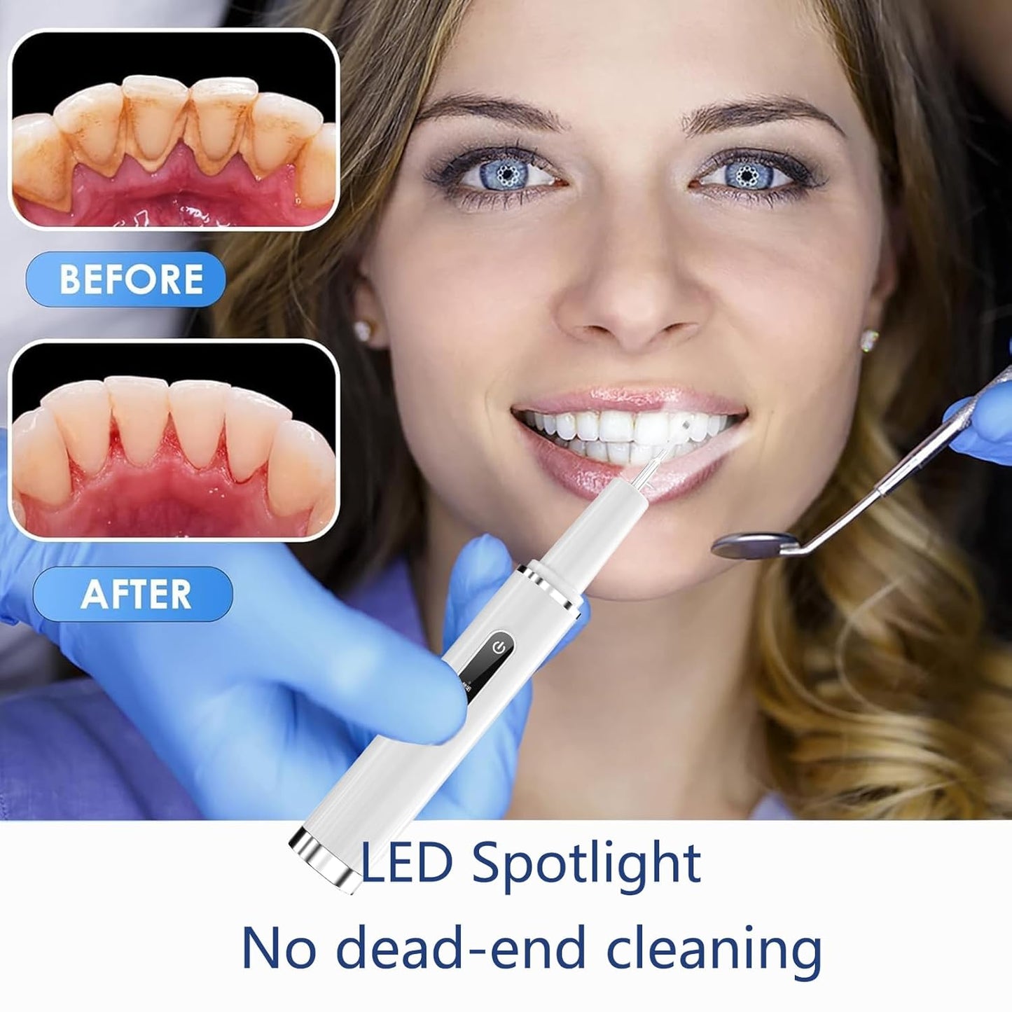 Professional Plaque Remover - Intelligent Teeth Cleaning Tool with 5 Modes & 4 Replaceable Heads | Dental Care Kit