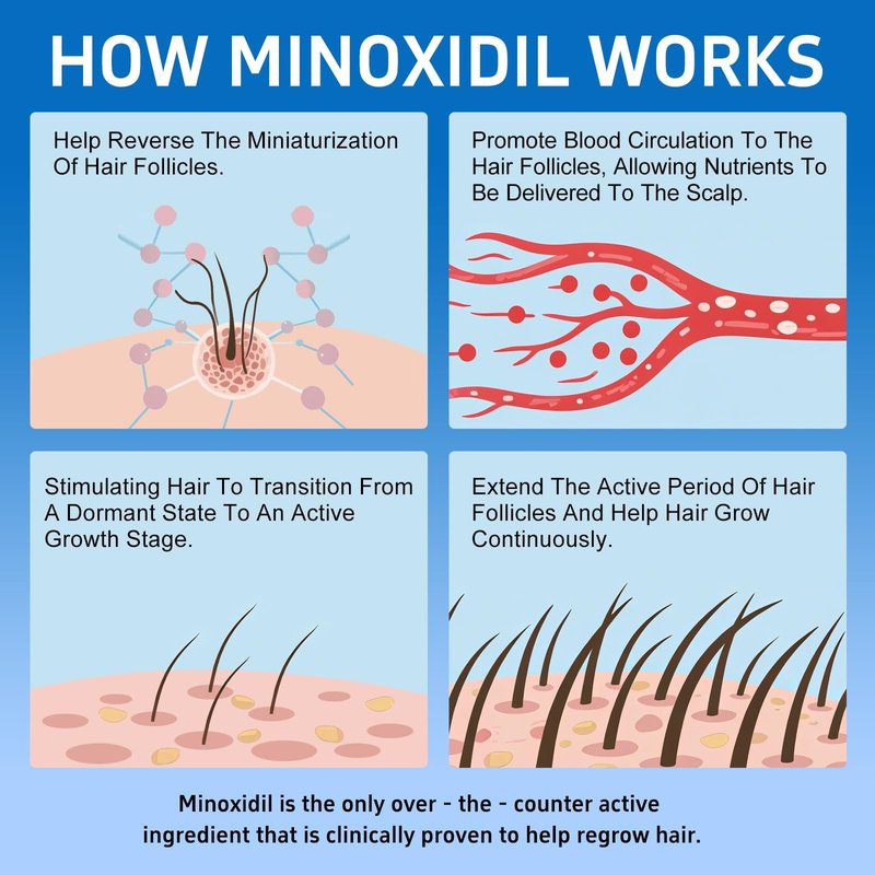 6 Packs, 5% Minoxidil with Biotin, Hair Growth Treatment, Minoxidil Hair and Beard Growth Oil, Minoxidil for Men and Women, Supports Thicker and Fuller Hair & Beard (12 fl oz, 6 Month Supply)