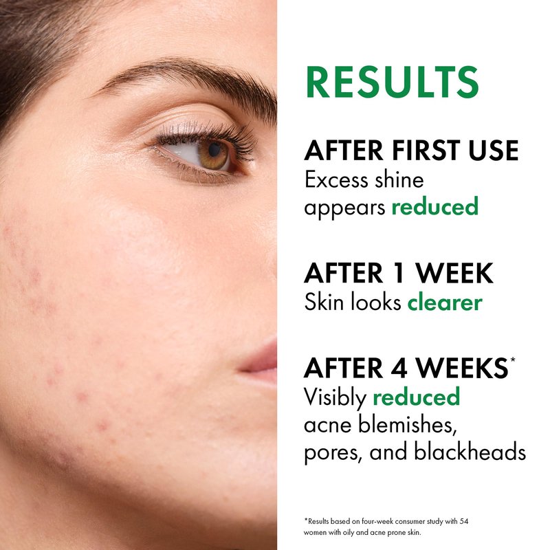 VICHY Normaderm Daily Acne Face Wash, 0.5% Salicylic Acid Cleanser, Gel Cleanser For Oily Skin, Removes Excess Oil, Dirt & Clogged Pores, Oil Free Acne Wash, Soap & Sulfate Free, Non-Drying