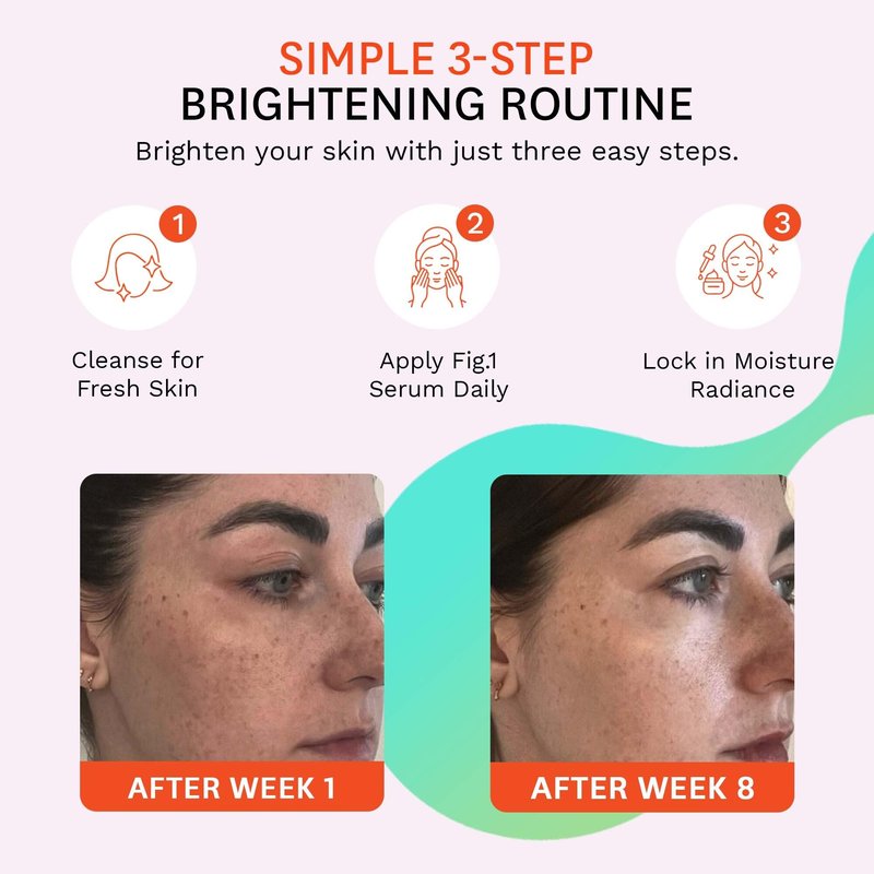 Fig.1 Even Tone Serum for Dark Spots & Uneven Skin Tone, Glowing Skin Face Serum with Niacinamide, Azelaic Acid, Tranexamic Acid & Alpha-Arbutin, Fragrance-Free, Safe for Sensitive Skin, 30ml