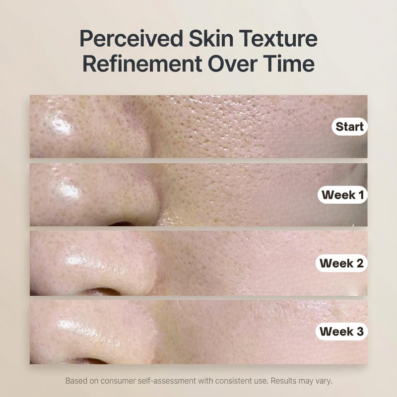 Glycolic Acid Pads with AHA BHA – Exfoliating for Face, 3% Glycolic & 0.5% Salicylic Acid, 7 cm Size, Supports Smooth Texture & Clear-Looking Pores, 70 Count