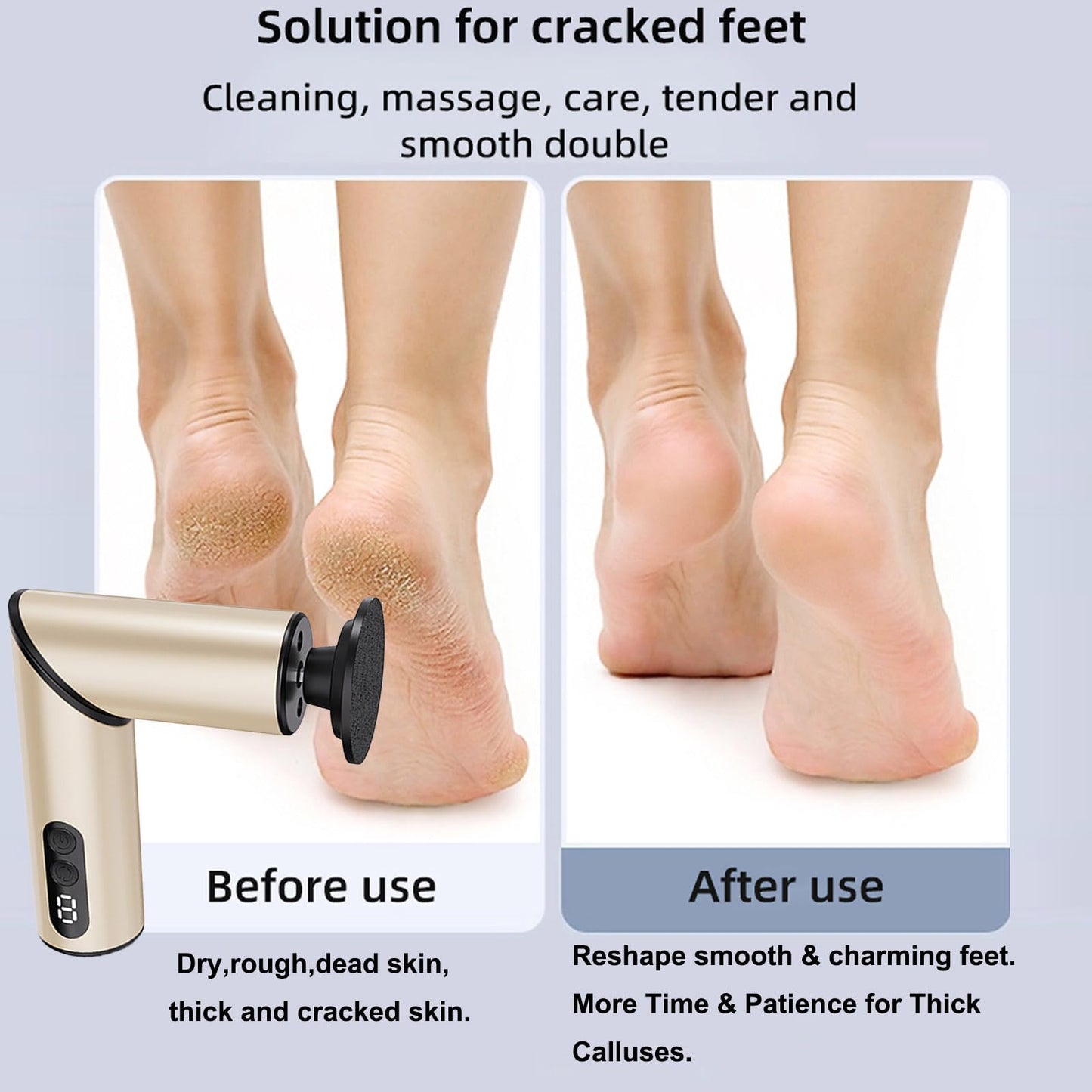 Chu&LiuXung Electric Callus Remover for Feet, Rechargable Fold Electric Foot Callus Remover Tool with Sandpapers,9 Adjustable Speed with Replaceable Grinding Heads for Callus,Cracks and Nails