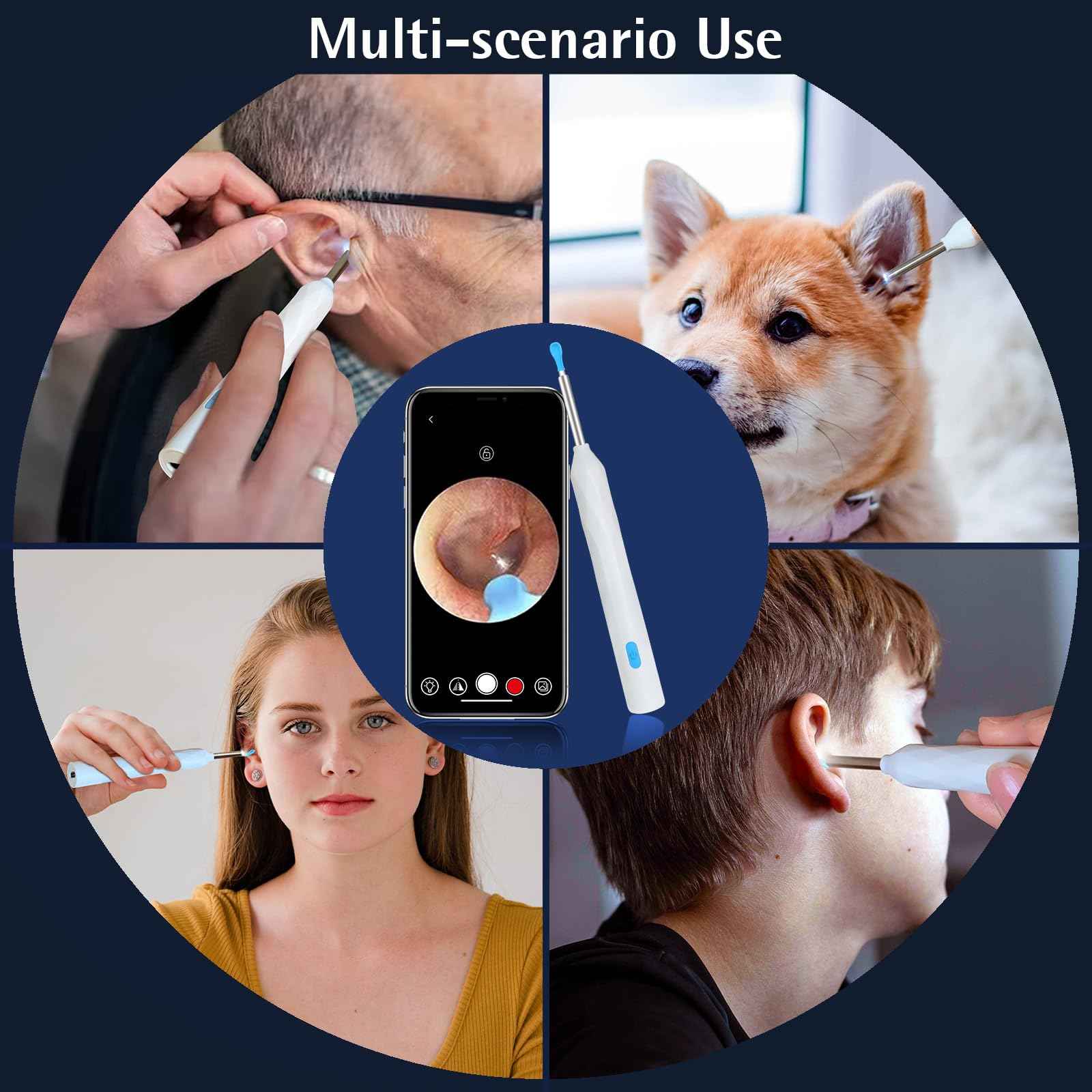 Ear Wax Removal, Ear Wax Removal Tool Camera with 1440P, Ear Cleaner with Camera and 7 Pcs Ear Set, Earwax Removal Kit with 6 Led Lights for iPhone, IPad, Android Phones (White)