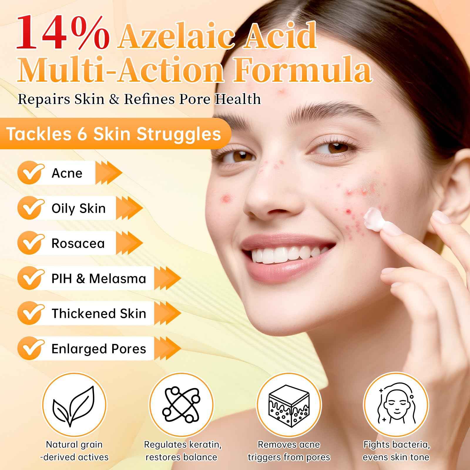 14% Azelaic Acid Acne Cream - Dark Spot Remover for Face, Acne Treatment & Spot Care Salicylic Acid & Niacinamide – Redness Reducing Skin Care, Evens Tone & Soothes Irritation, Rosacea - 2 Pcs.1oz