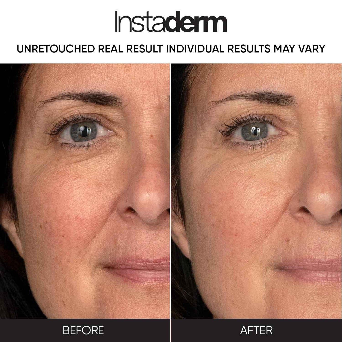 Retinol Skin Booster Cream- Age-Defying formula That Visibly Reduce The appearance of Fine Lines & Wrinkles. Improve Firmness, Elasticity, Thickness Of The Skin & Evens skin Tone.