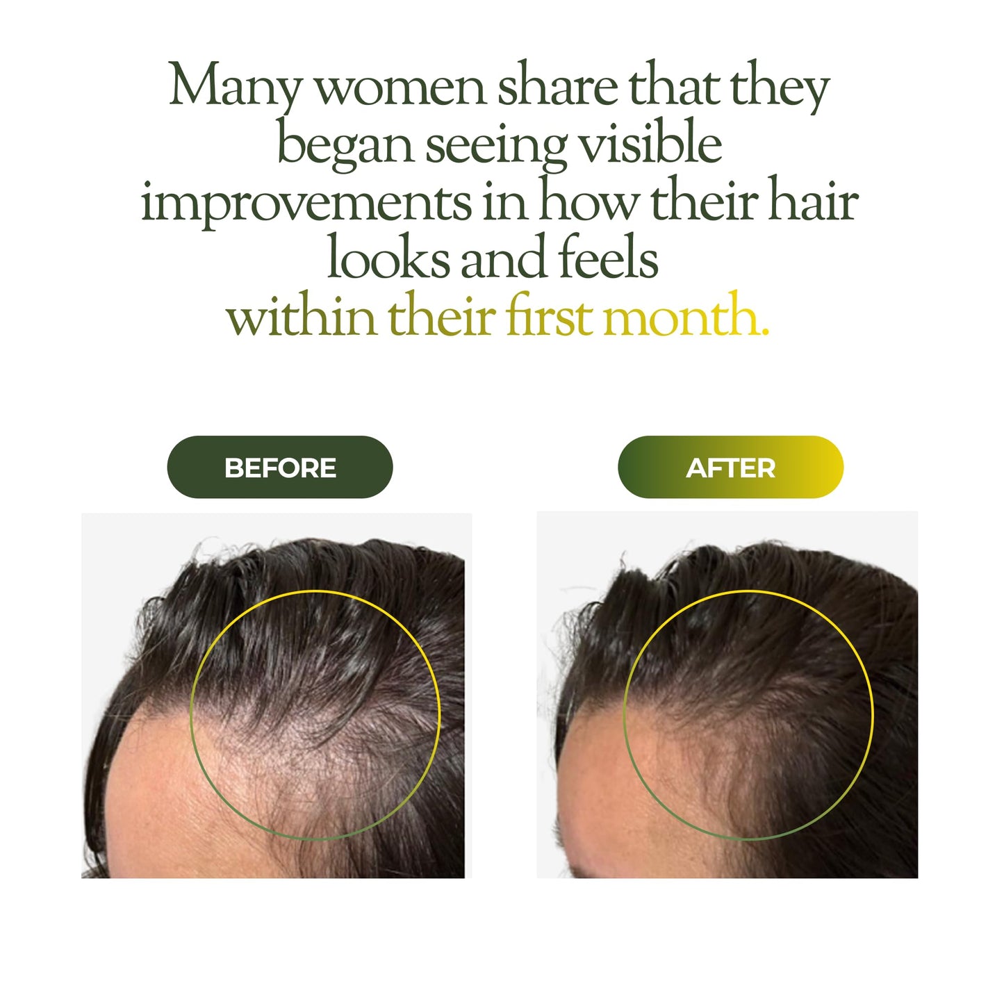 regener8 Hair & Scalp Oil for Women – Essential & Carrier Oil Blend for Hormone-Related Thinning & Loss – Natural Support for Postpartum, Menopause & Chronic Stress