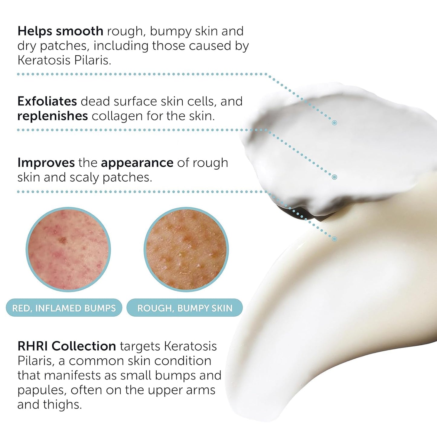 KP Bump Eraser Body Set with 10% AHA | Keratosis Pilaris Treatment | Keratosis Pilaris Lotion | Exfoliating Body Scrub | Ingrown Hair Treatment | Bundle Set for Bump, Strawberry Legs, Redness, Dryness