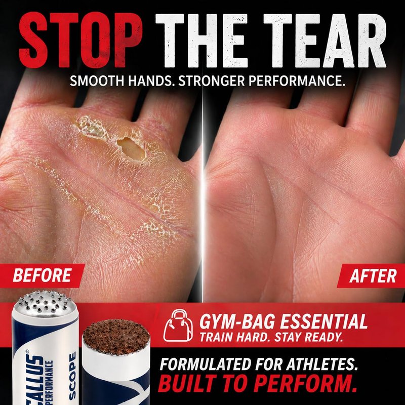Callus Performance Ultimate Bundle: Precision Remover, Healing Salve & 2 Smoothers | Hand Care System for Weightlifting, Gymnastics & Functional Fitness | Prevents Rips When Training