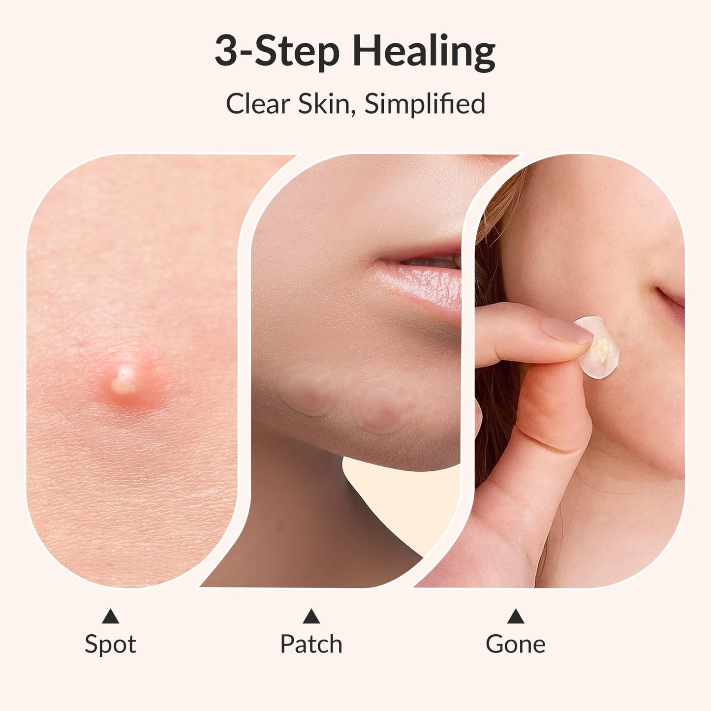 RPE Life Invisible Pimple Patches – 4 Sizes Miracle Patches for Pimples with Hydrocolloid & Salicylic Acid, Korean Acne Patches for Face, Zit Stickers, Blemish Patches, Acne Spot Dots – 144 Count