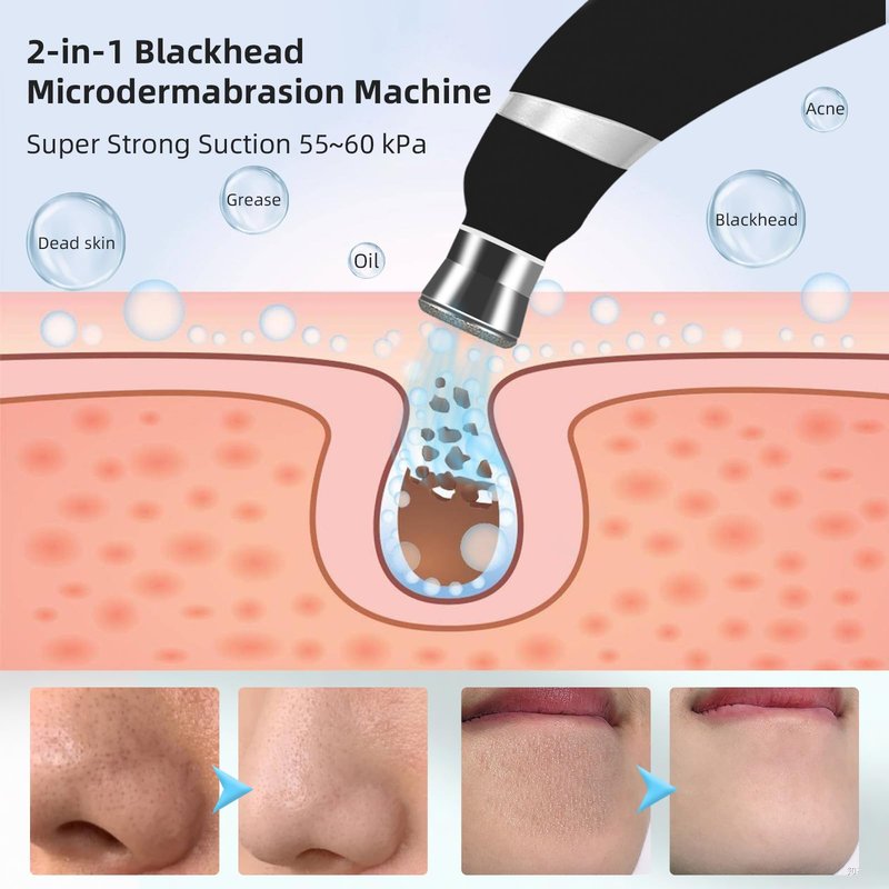 IeBilif Diamond Microdermabrasion Machine, 3 Modes Diamond Microdermabrasion Dermabrasion Machine for Blackhead Removal, Portable Microdermabrasion Tool with 8 Diamond Tips