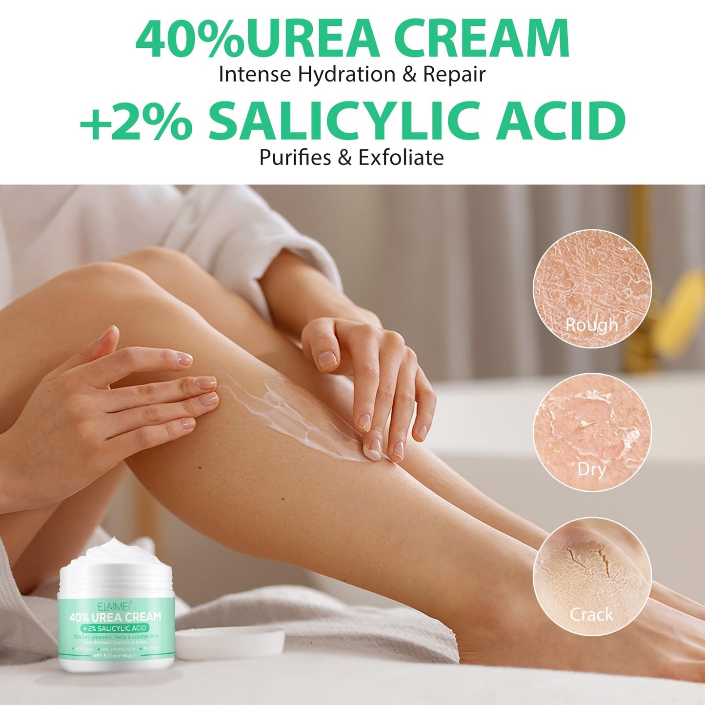 Jiugonggang 40% Urea Cream with 2% Salicylic Acid for Dry Cracked, Feet/Heel Cream Moisturizer for Dry Cracked Heel, Knees, Elbows, Hands, Callus Remover, Callus Remover,Feet Repair Cream, 5.3 Oz