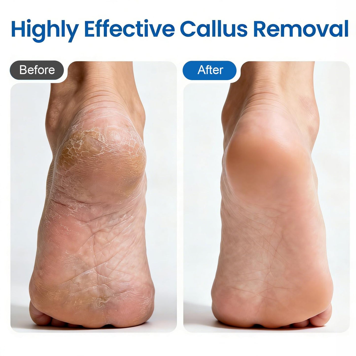 Electric Foot Callus Remover with 60 Pcs Sandpaper Discs, Adjustable Speed Electric Foot File Grinder, Professional Pedicure Tool for Dead Skin & Cracked Heel