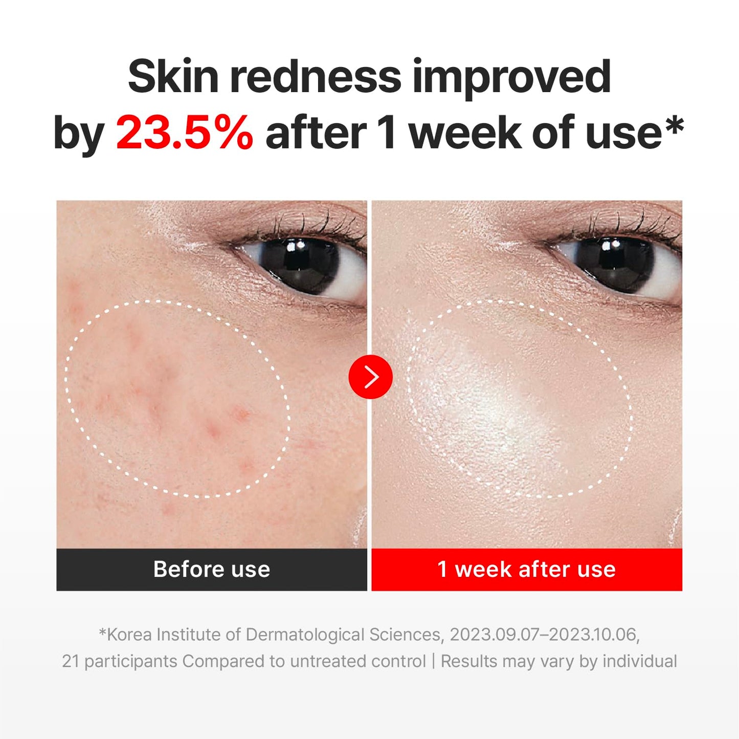 CENTELLIAN 24 Madeca Cream Time Reverse (50ml/1.69fl oz, Pack of 2) Advanced Fast-Absorbing & Nourishing Cream, Hydrates, Reduces Wrinkles, Korean Skin Care, Centella Asiatica