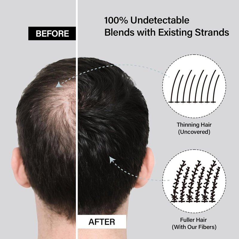 Hair Building Fibers - Thicker Fuller Hair & Beard Enhancer | 2-in-1 Kit with Spray Applicator (Black)