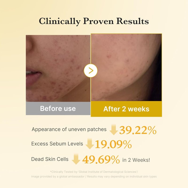 Kojic Acid Clarity Duo - Turmeric Clarifying Pad & Smoothing Toner for Troubled Skin | Face & Body Care