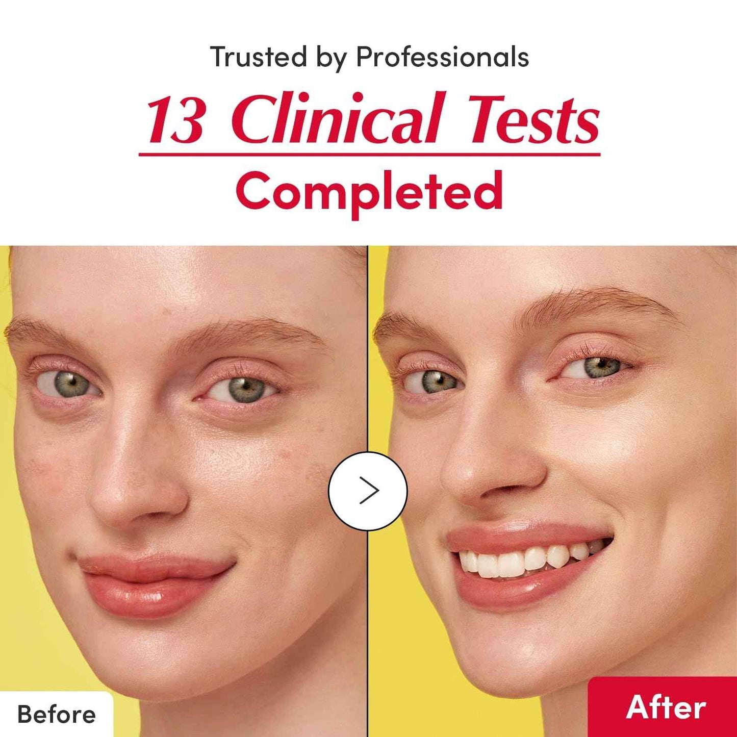 EQQUALBERRY Vitamin Illuminating Serum – Brightening Vitamin C Serum with Niacinamide | Strengthens skin barrier | Hydrates using Ceramide and Hyaluronic Acid, 1.01oz / 30ml