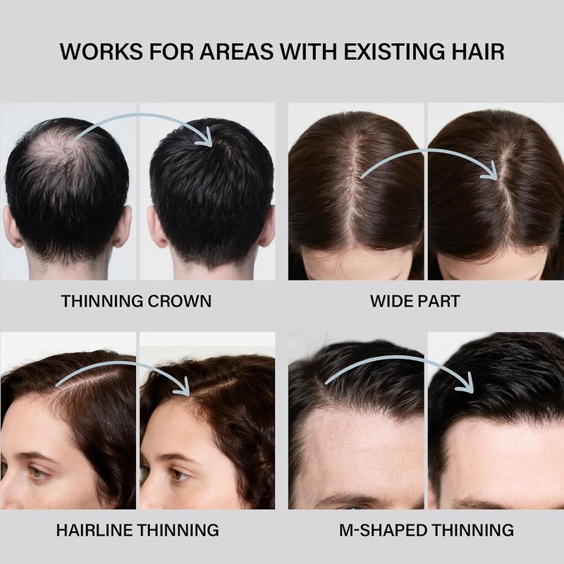 Hair Building Fibers - Thicker Fuller Hair & Beard Enhancer | 2-in-1 Kit with Spray Applicator (Black)