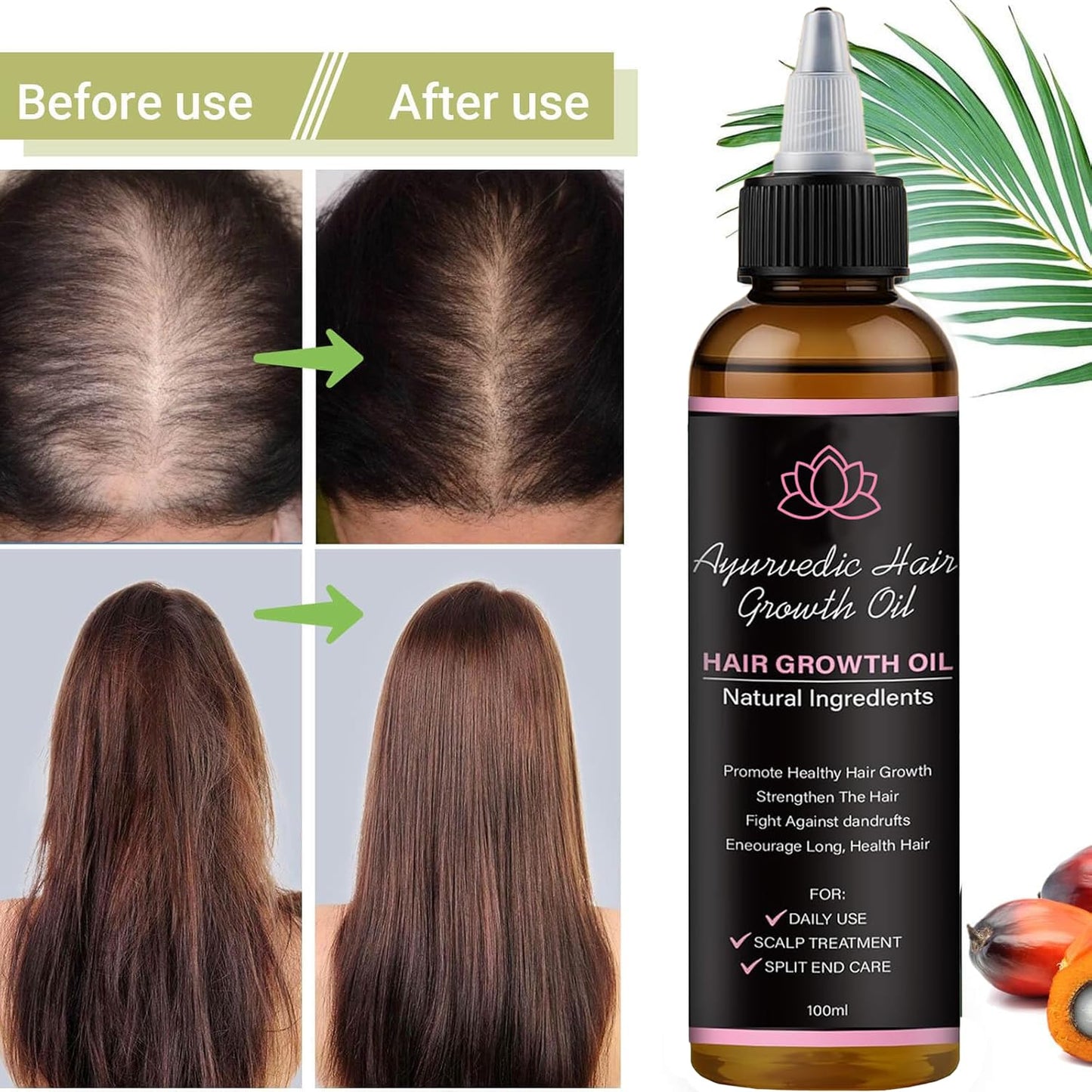 Lifewitqueenp Hair Care Growth Oil, Queenp Ayurvedic Hair Growth Oil, Lightweight for All Hair Types (1pcs)