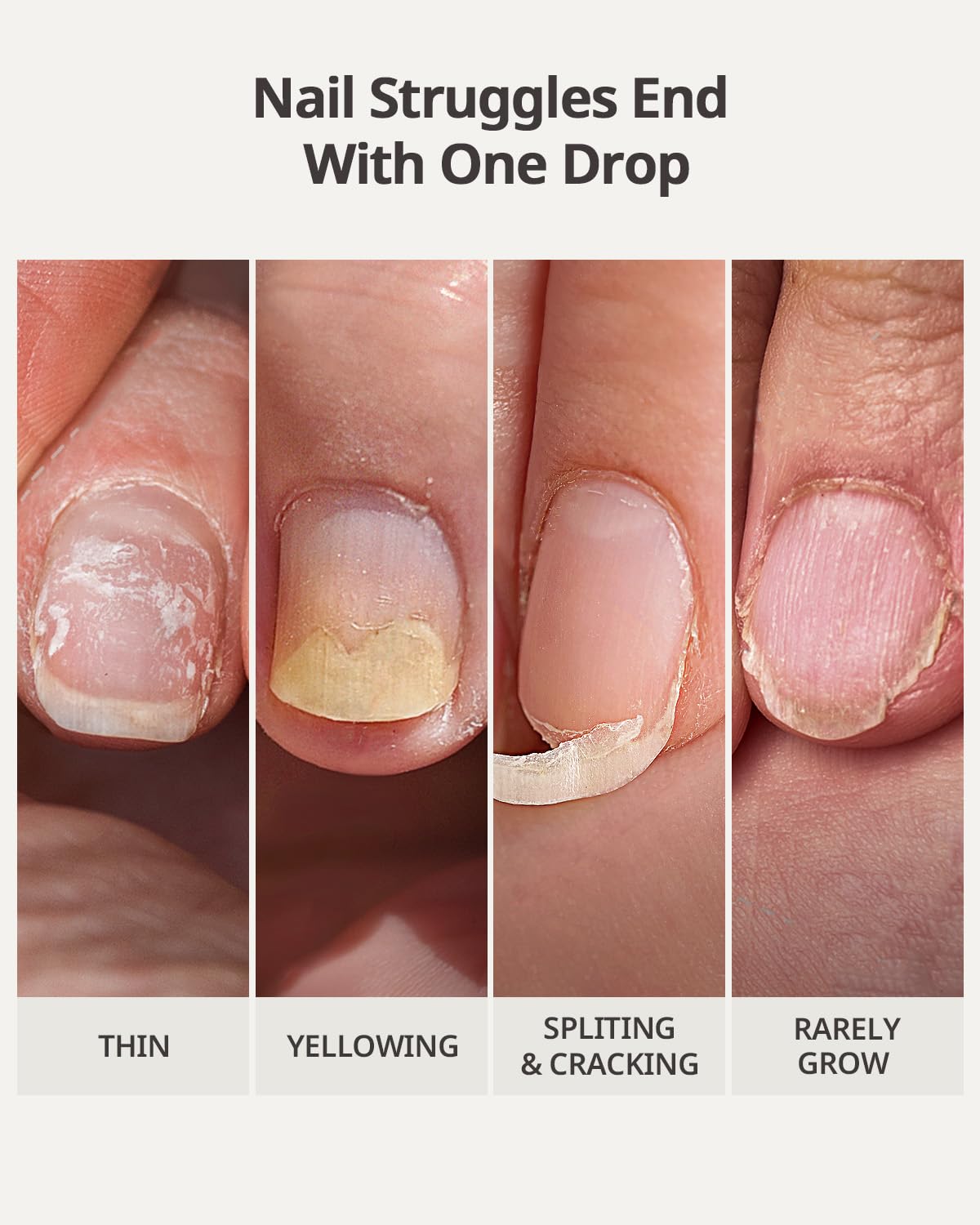BTArtboxnails Naillush Nail Strengthener & Growth - Repair Damaged Nails, Strengthen Weak & Thin Nails, Extra Strong Nail Growth Treatment, Long Lasting Nail Hardener, 15ml