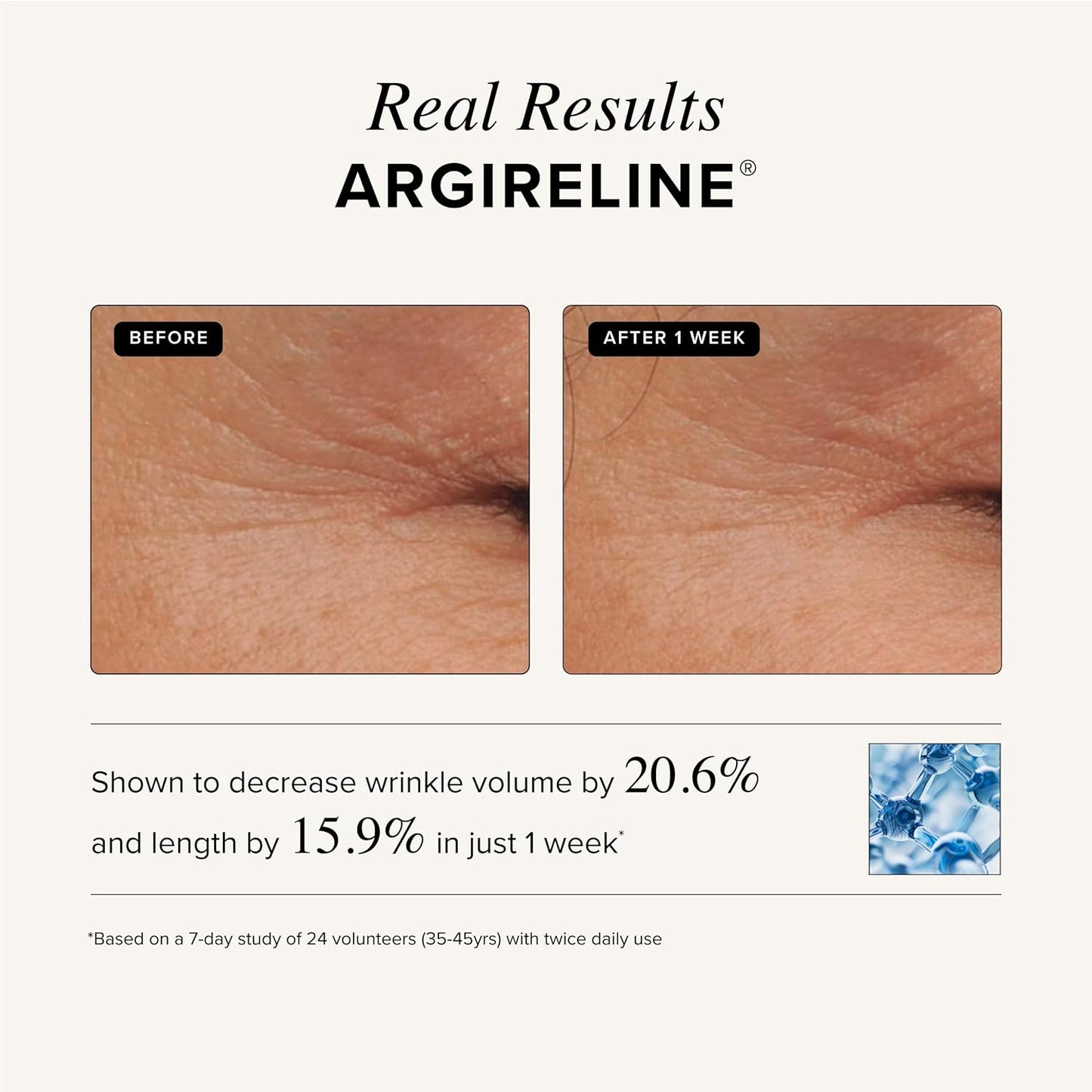 Asterwood Matrixyl 3000 Serum - Anti-Aging Hyaluronic Acid & Vitamin C for Hydration | 1 Fl Oz