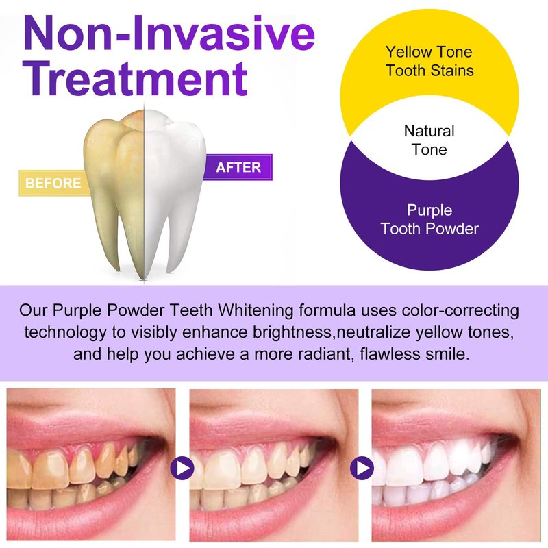Teeth Whitening Powder - Teeth Whitening - Removes Stains - No Sensitivity - Enamel-Safe Toothpaste Power - Breath Freshener - for Coffee, Tea and Tobacco Stains 10g