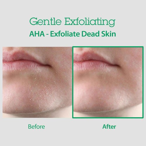 BLITHE AHA BHA Cleanser - Deep Pore Cleanser and Pore Minimizer, Exfoliant for Face, For Clogged Pores, 5.07 Fl Oz